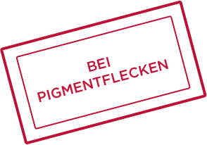 BEI PIGMENTFLECKEN